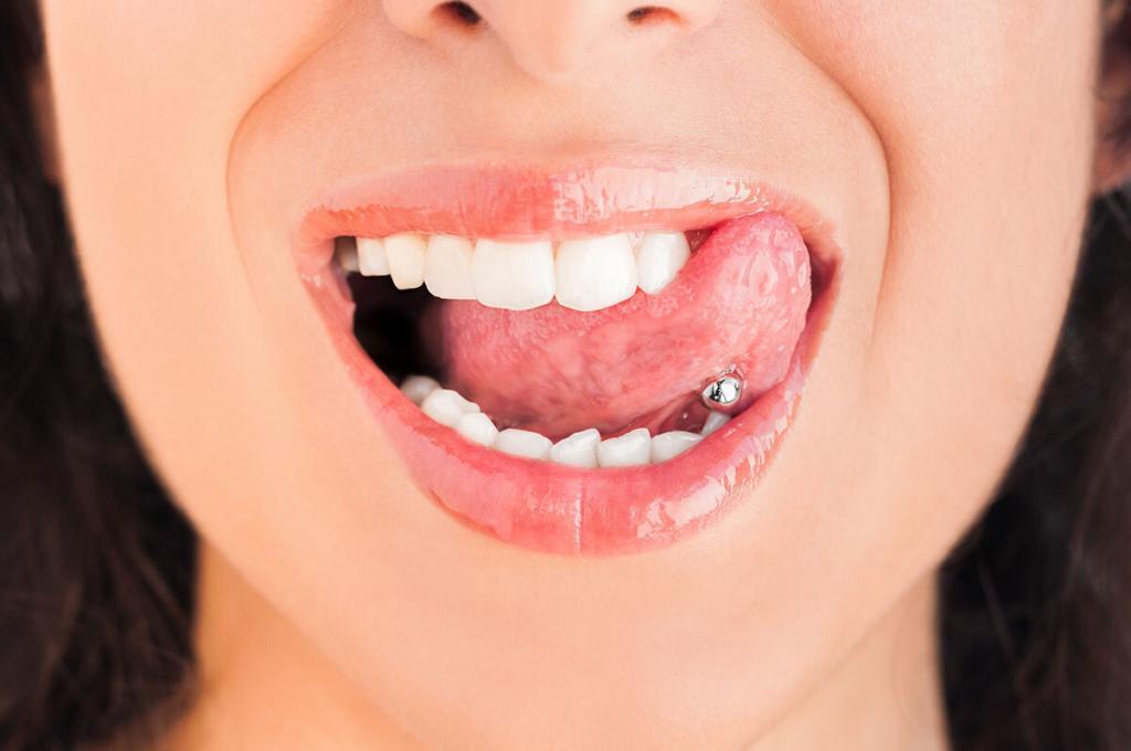 Can a Tongue Piercing Affect Your Teeth