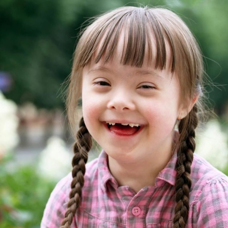 down syndrome dentist